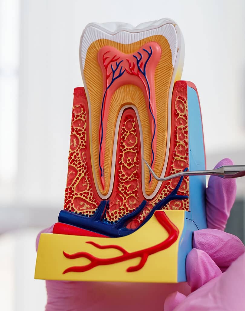 Root Canal Treatment – Smile 360