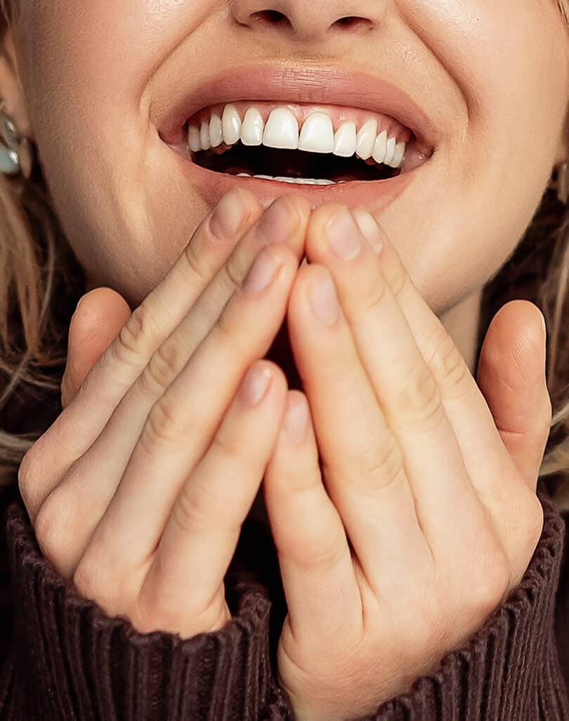 Teeth Whitening – Smile 360