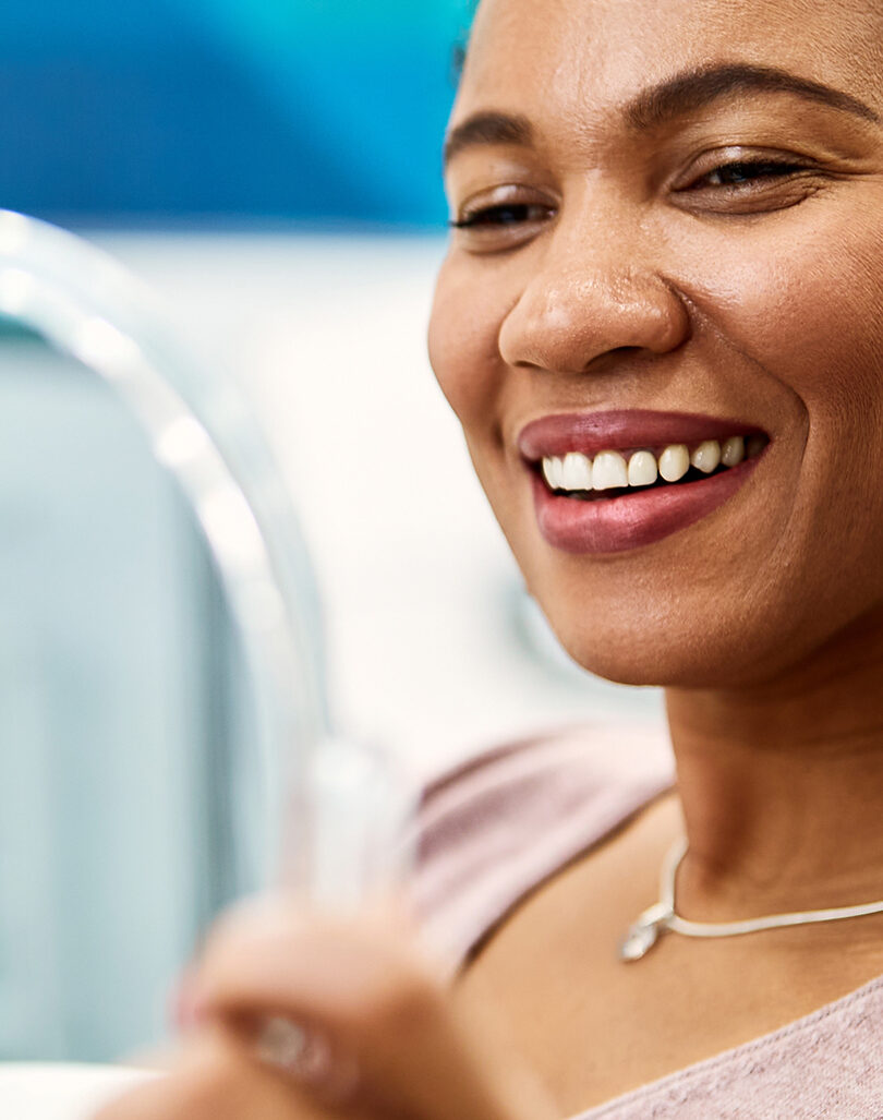 White Fillings – Smile 360